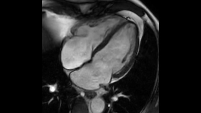 Клінічне зображення головного мозку