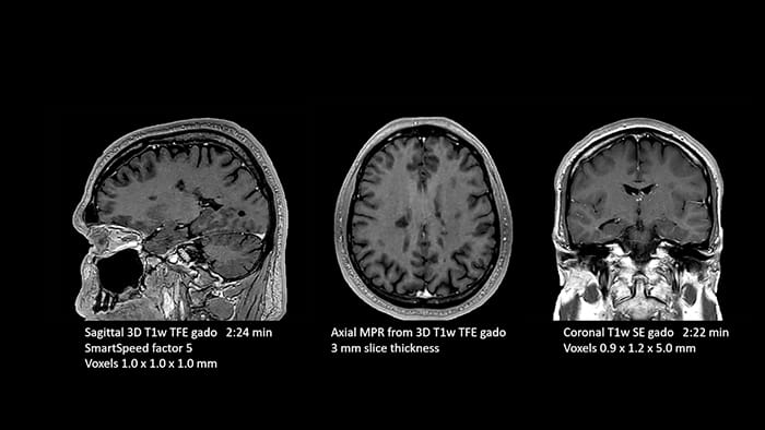Brain image two