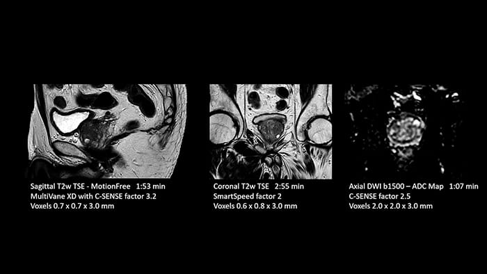 Prostate image two