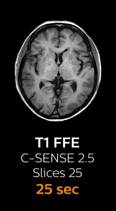 T1 FFE